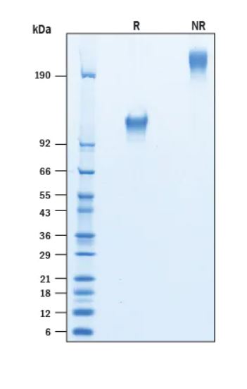 2 μg/lane Protein  was resolved with SDS-PAGE under reducing (R) and non-reducing (NR) conditions and visualized by Coomassie® Blue staining.